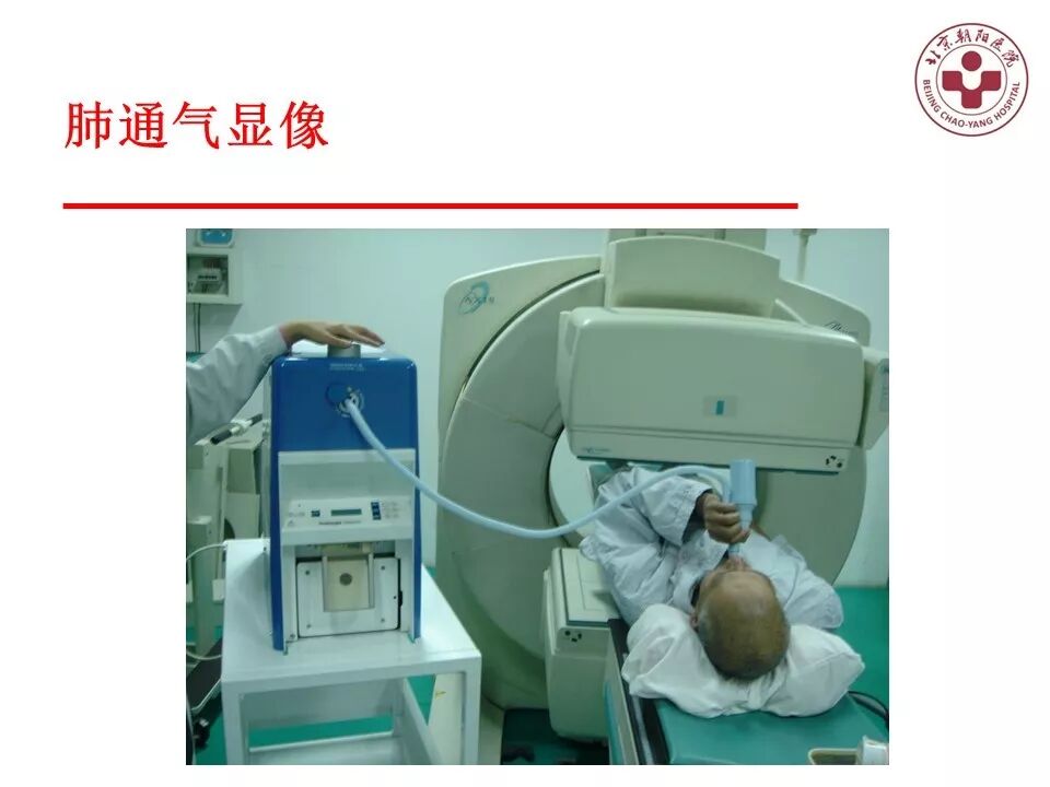 d-spect怎么检查【核汇园】20期：王铁教授 ｜《肺通气-灌注SPECT／CT显像评价肺动脉栓塞》_https://www.jmylbn.com_新闻资讯_第13张