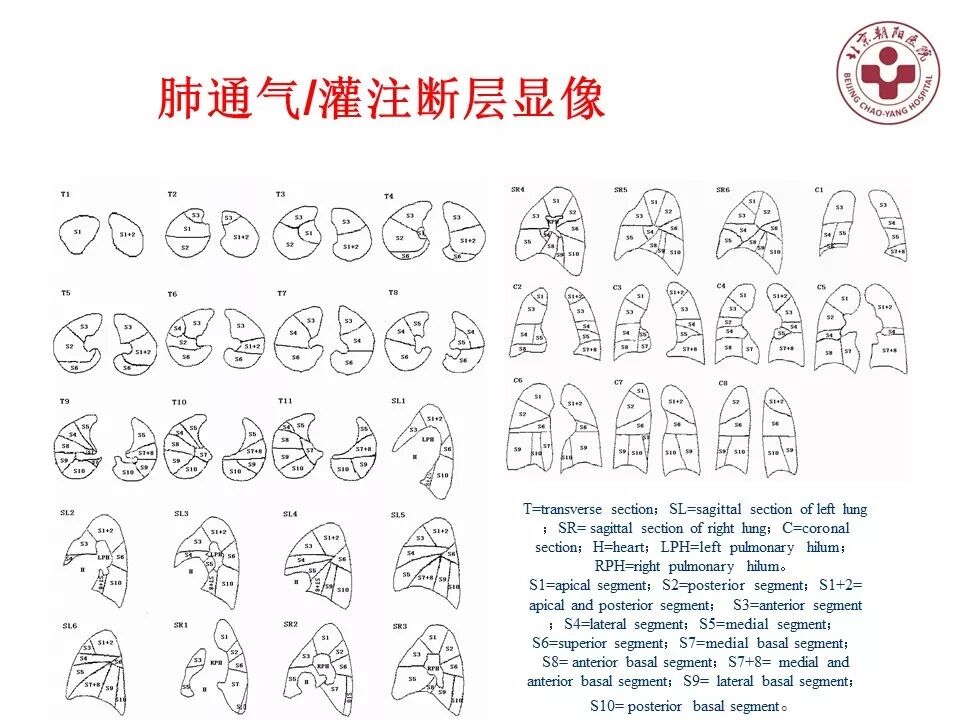 d-spect怎么检查【核汇园】20期：王铁教授 ｜《肺通气-灌注SPECT／CT显像评价肺动脉栓塞》_https://www.jmylbn.com_新闻资讯_第38张