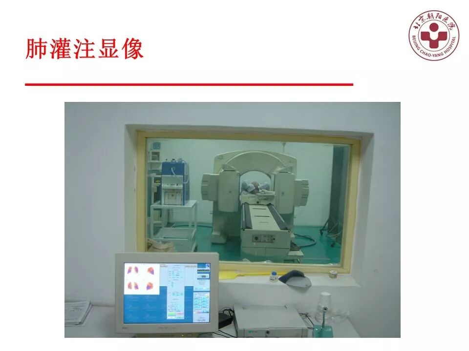 d-spect怎么检查【核汇园】20期：王铁教授 ｜《肺通气-灌注SPECT／CT显像评价肺动脉栓塞》_https://www.jmylbn.com_新闻资讯_第14张