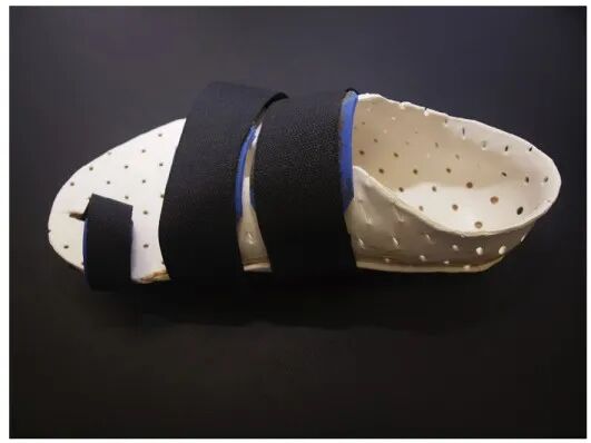 【手术技巧】拇外翻非截骨韧带联合术（Syndesmosis