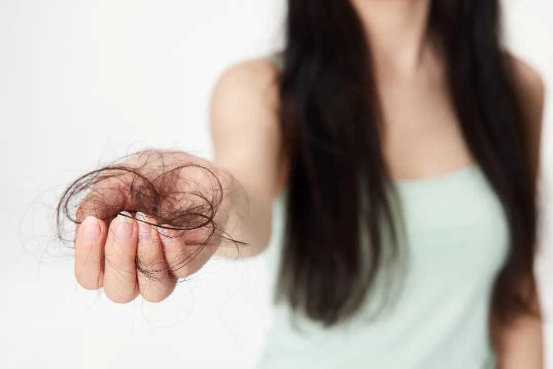 FUE怎么提取毛囊自测一下，你是否脱发？FUE 和 FUT植发技术各有利弊，看完你会选择哪一种？_https://www.jmylbn.com_新闻资讯_第2张