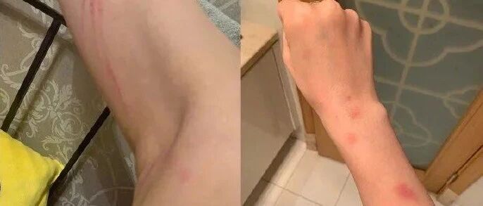 妻子怒斥被知名运动员家暴、出轨：抓着我头发撞墙！男方最新回应