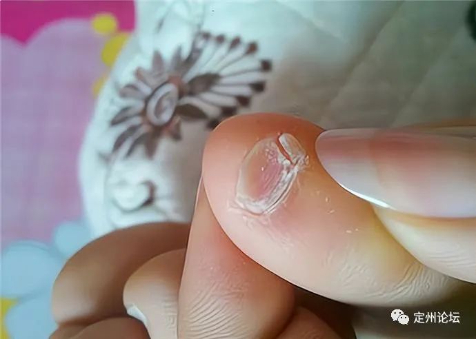 快低头看看你的小脚，趾甲是不是两瓣的？