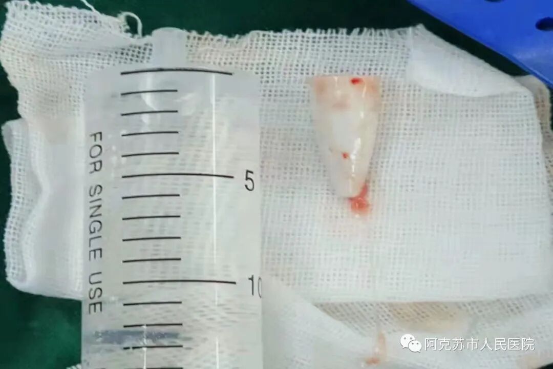 图片来源：阿克苏市人民医院
