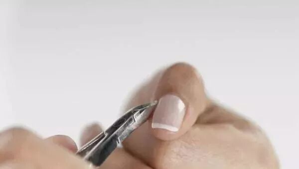 灰指甲最佳治疗方法,灰指甲最快治疗方法