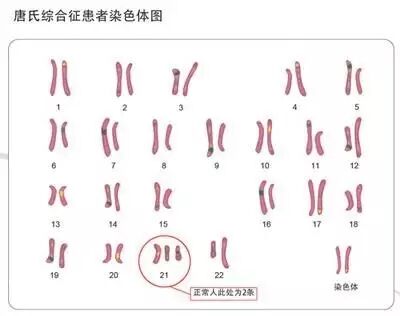 每半分钟就有一个缺陷儿出生,二胎时代,我们需要注意什么?