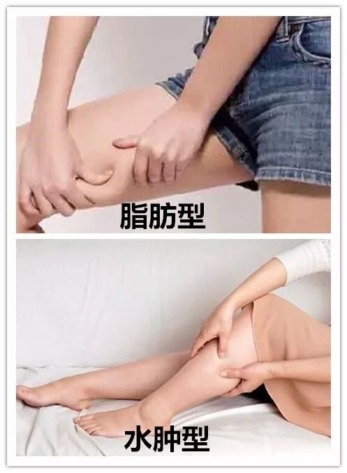 瘦腿效果堪比ps 全球300万人都在吃的dhc瘦腿丸 平价中的瘦腿战斗机 自由微信 Freewechat