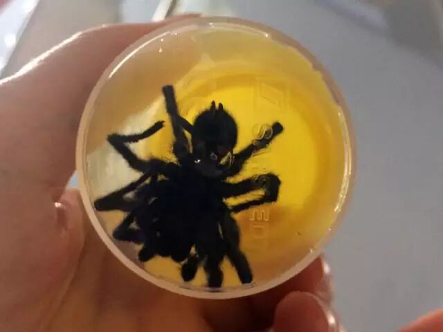 注意！澳剧毒蜘蛛繁殖高峰来了！叮一下就触发神经病！澳男孩家中被蜘蛛袭击，浑身肿胀癫痫发作！ - 24