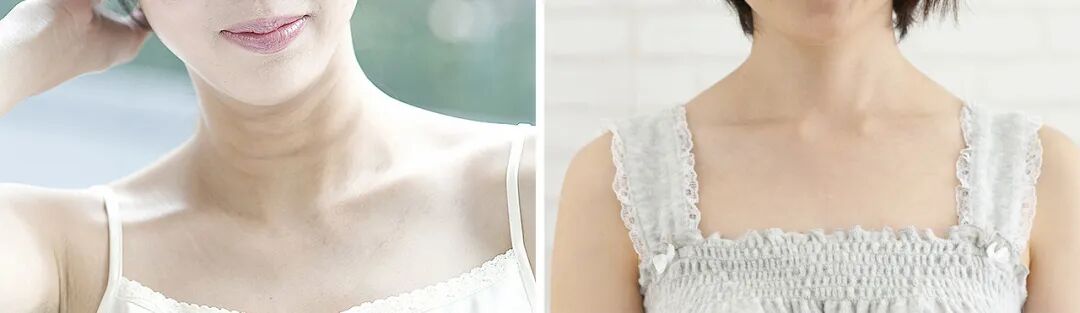 SOMADERM | 女人没有颈纹，至少比同龄人年轻好几岁！