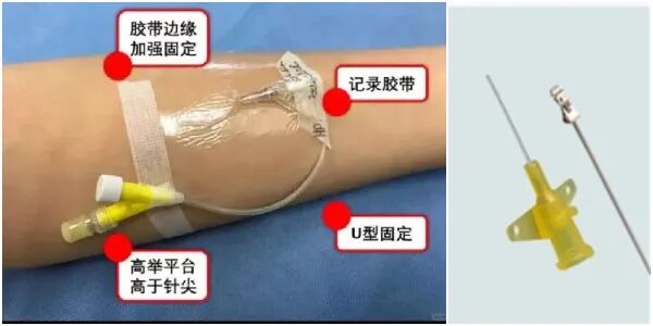 为什么输血不能用小针“静”系生命   “针”心呵护_https://www.jmylbn.com_新闻资讯_第3张