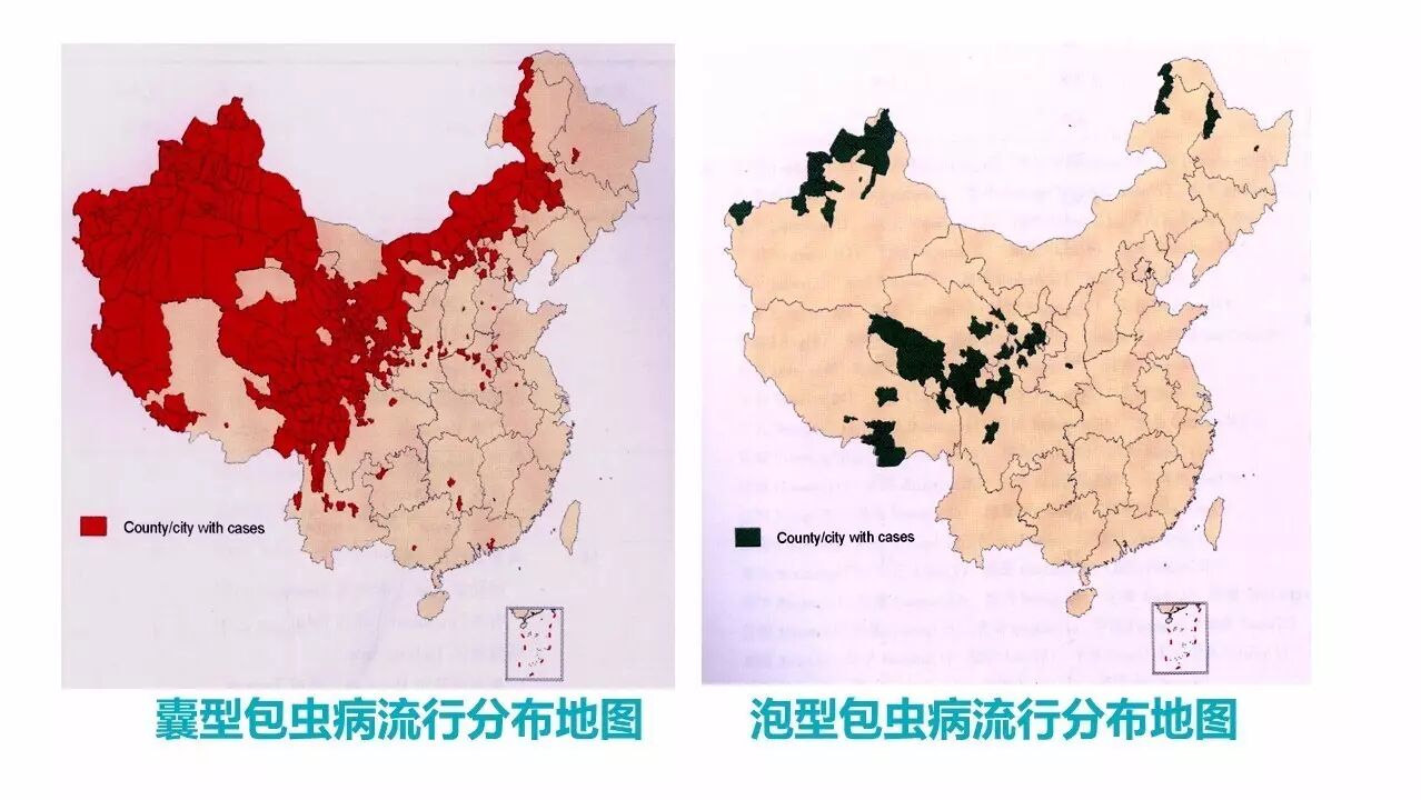 包虫病的影像学特点