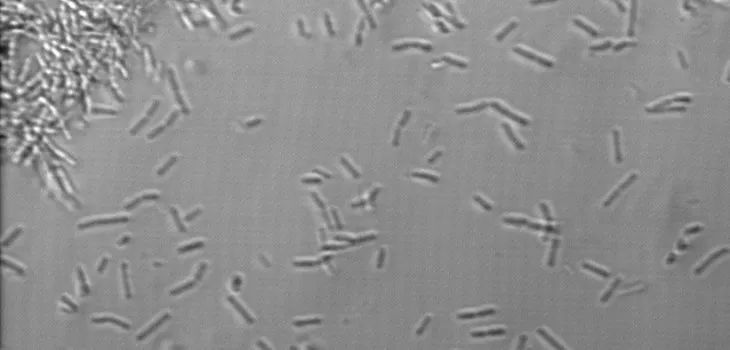使用特定选择性培养基进行粪便培养,分离出霍乱弧菌从而确诊霍乱