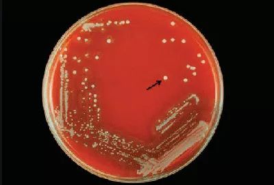 腐生葡萄球菌血平板图片