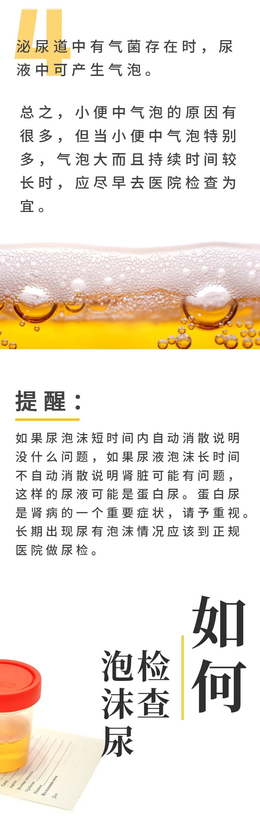 世界肾病日主题宣传泡沫尿与肾病的鉴别