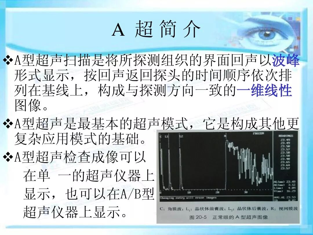 眼科a超报告单怎么看眼科A超 ｜ 基本原理和临床应用_https://www.jmylbn.com_新闻资讯_第11张