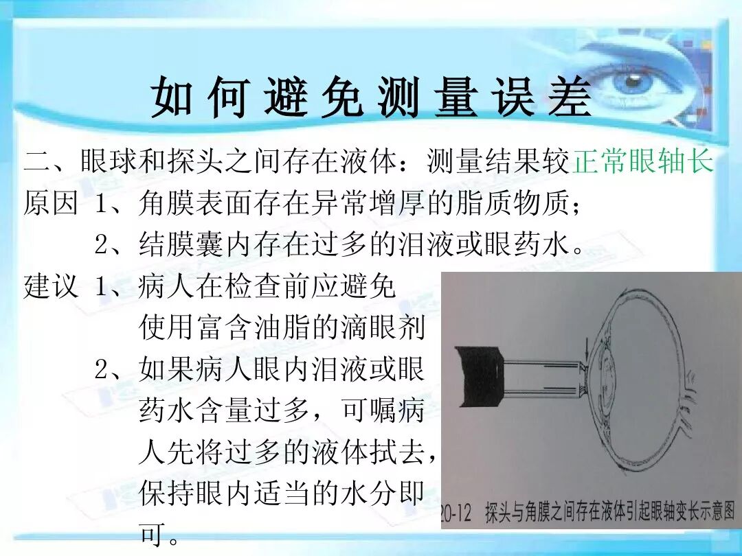 眼科a超报告单怎么看眼科A超 ｜ 基本原理和临床应用_https://www.jmylbn.com_新闻资讯_第24张