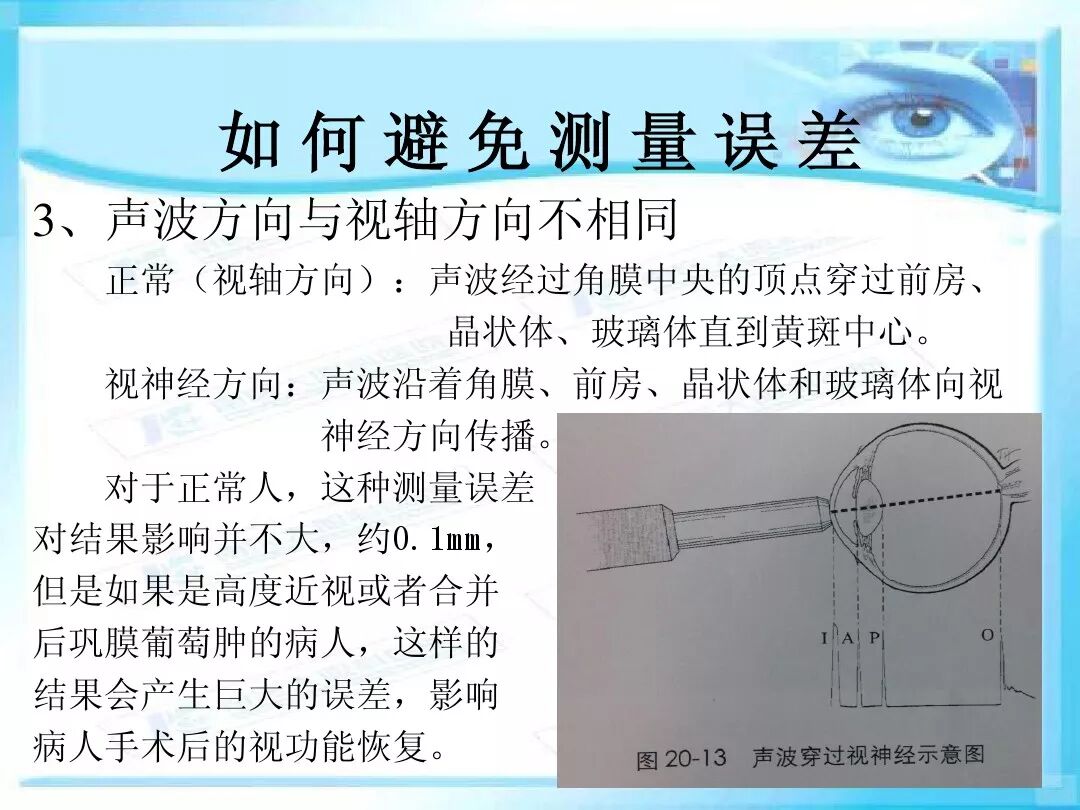 眼科a超报告单怎么看眼科A超 ｜ 基本原理和临床应用_https://www.jmylbn.com_新闻资讯_第25张