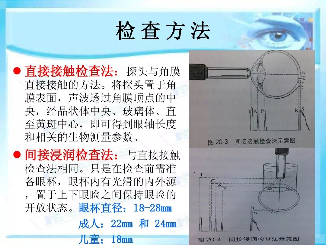 眼科a超报告单怎么看眼科A超 ｜ 基本原理和临床应用_https://www.jmylbn.com_新闻资讯_第19张