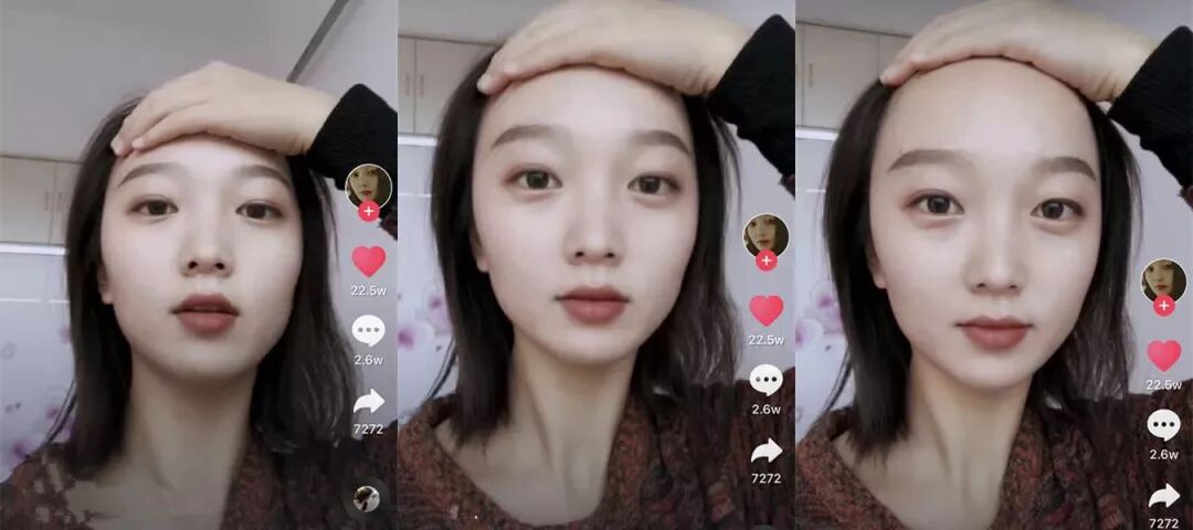 当代秃头少女4个月自救指南，过了30岁再护发，就来不及了！