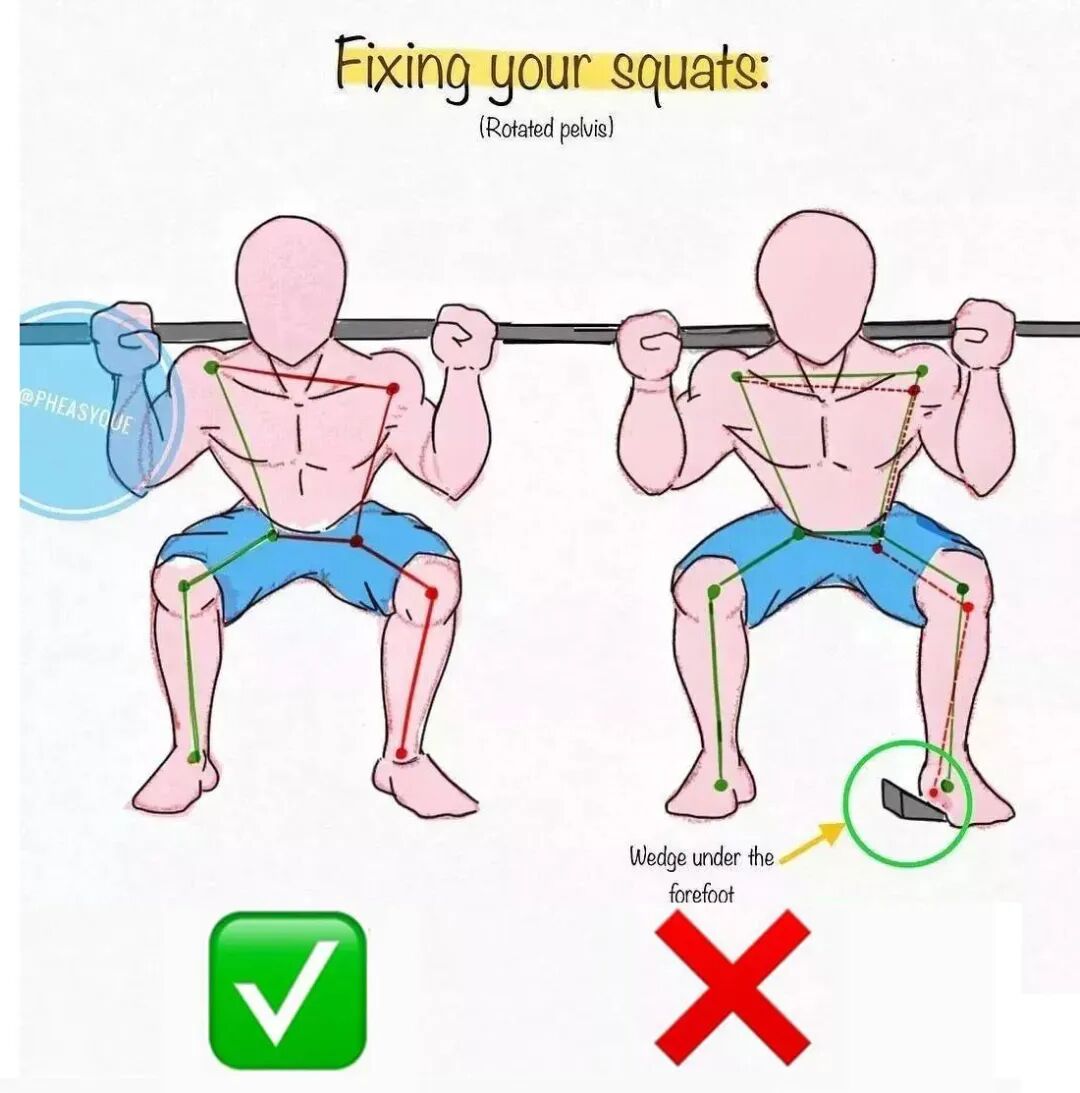 前臂旋前式的正握握法但是手腕一定要保持中立位否则手腕很可能就废了