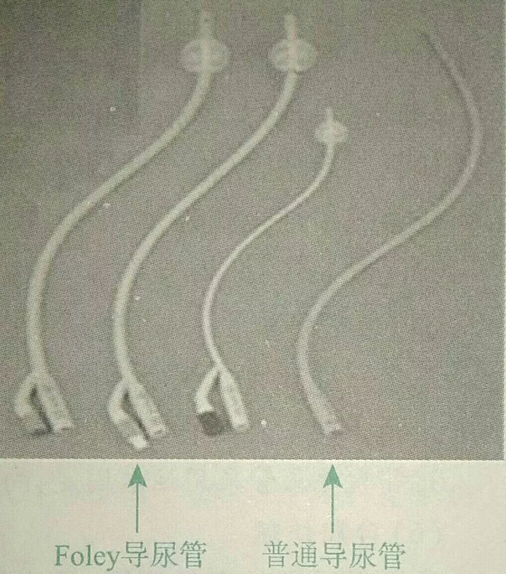 为什么要用一次性导尿包导尿术_https://www.jmylbn.com_新闻资讯_第2张