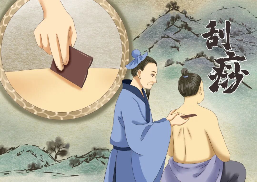 上火刮痧着凉拔罐对吗专家这样说