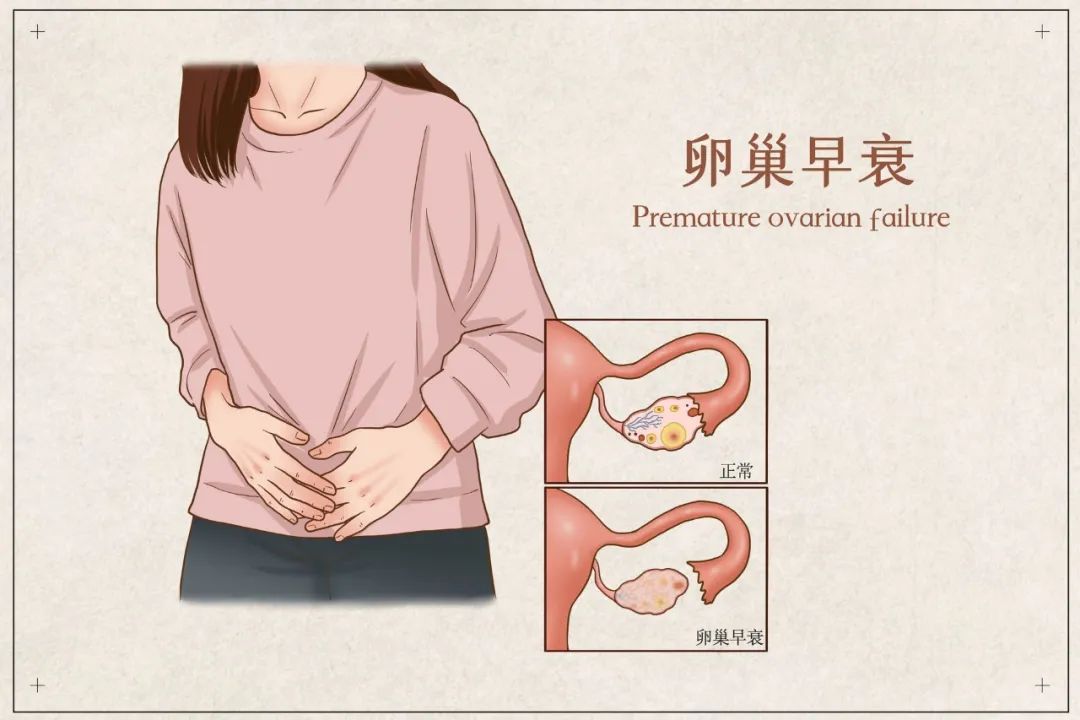 女性卵巢位置示意图图片