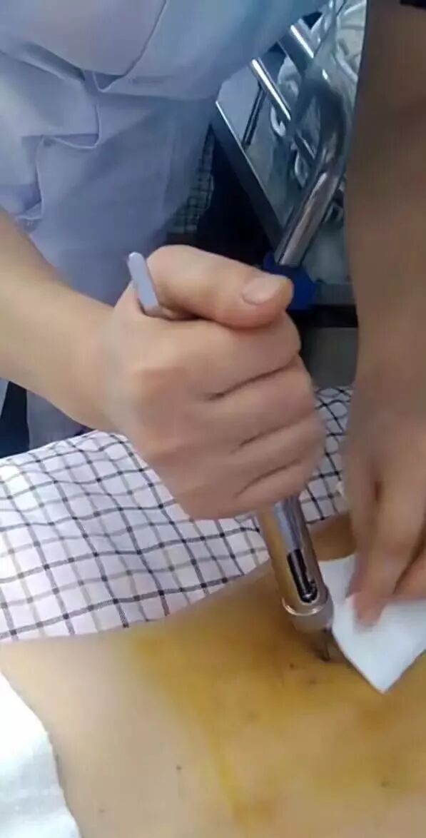 枪针怎么用医用麻醉枪拆卸安装保养维护使用大全【收藏】_https://www.jmylbn.com_新闻资讯_第5张