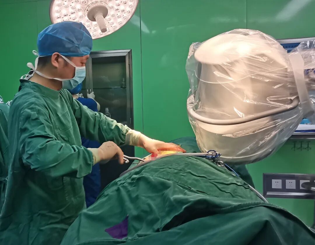 c臂机怎么开机全新C型臂X射线机，助医师一“臂”之力_https://www.jmylbn.com_新闻资讯_第8张