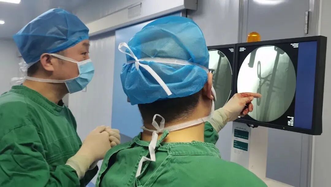 c臂机怎么开机全新C型臂X射线机，助医师一“臂”之力_https://www.jmylbn.com_新闻资讯_第11张