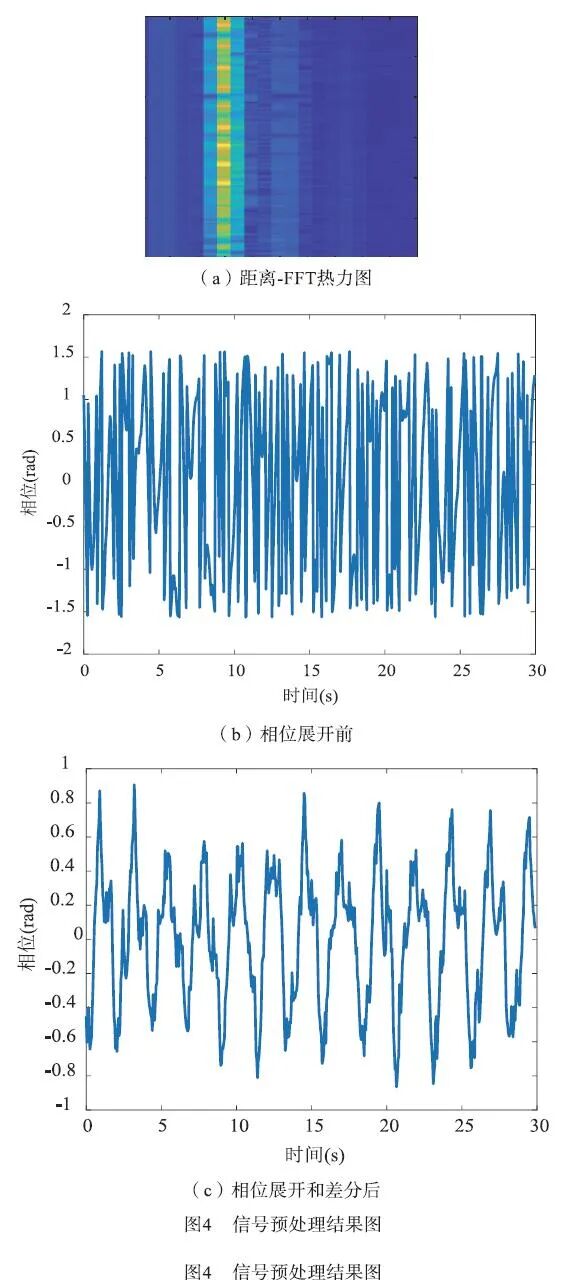 心率变异率怎么测基于毫米波雷达的心率变异性检测方法_https://www.jmylbn.com_新闻资讯_第14张