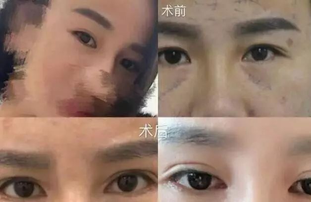 聚焦 一女子在整形美容医院整形失败 状告卫计委不作为 中国美容医学杂志 微信公众号文章阅读 Wemp