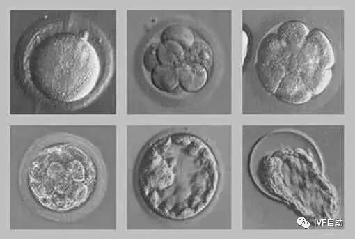 养囊三天成功率多少_养囊三天看卵子五天看精子_三天养囊结果