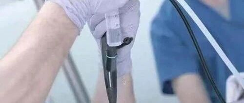 6毫米的小息肉，短短3年变成癌！这篇息肉最全科普，希望看到还不晚！