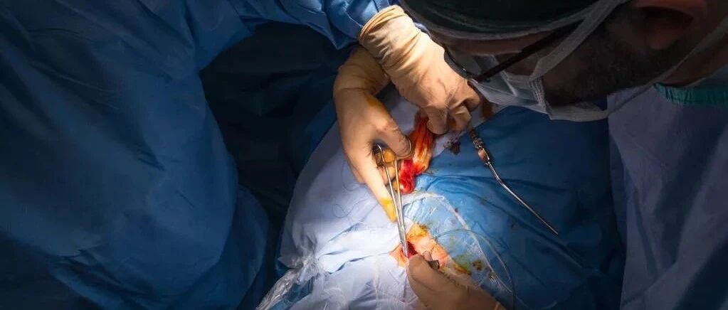 医生硬着头皮上手术台后......真该让所有患者都看一看！