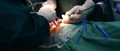 夫妻双双手术换掉膝盖！罪魁祸首竟是坚持10年的"好习惯"！