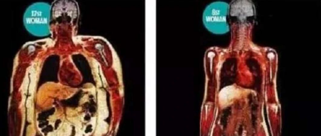 寿命短的人，身上2处是“圆”的，如果你也是，一定要重视起来！