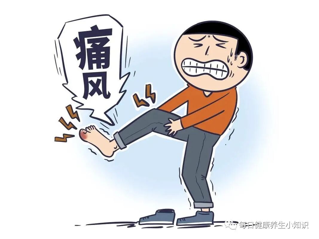 90后已经开始痛风了如何预防痛风以下是几个实用建议