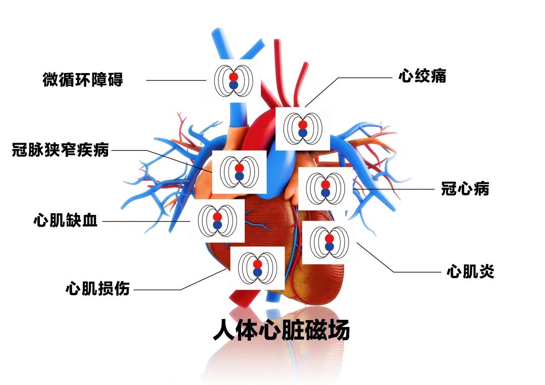 心脏检测仪怎么看选“对”不选“贵”！心脏检查才精准！_https://www.jmylbn.com_新闻资讯_第6张