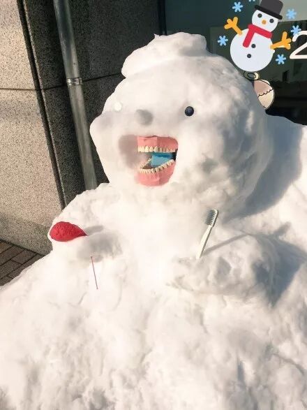 为什么牙医不用开口器我不打麻药，我只要牙医给我讲段子！_https://www.jmylbn.com_新闻资讯_第4张