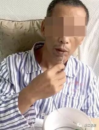 怎么拔鼻腔引流管胃管术（二）_https://www.jmylbn.com_新闻资讯_第37张