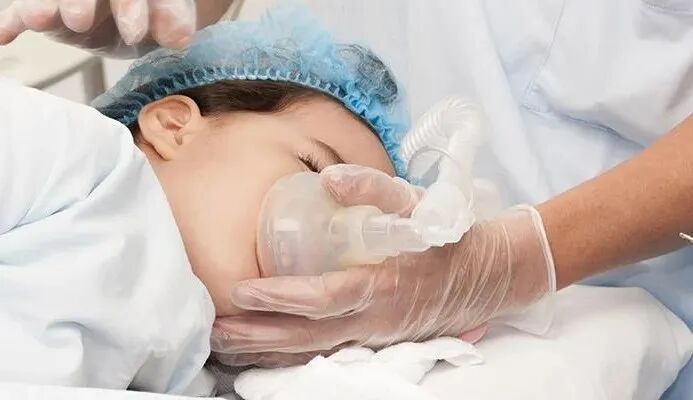 呼吸回路管怎么使用李军教授：儿科麻醉气道管理技术分享_https://www.jmylbn.com_新闻资讯_第4张