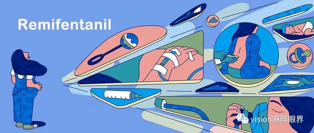 椎管内分娩镇痛首选替代方案——瑞芬太尼