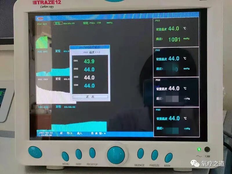 什么是经皮氧分压经皮氧分压测定在高压氧学科的应用_https://www.jmylbn.com_新闻资讯_第9张