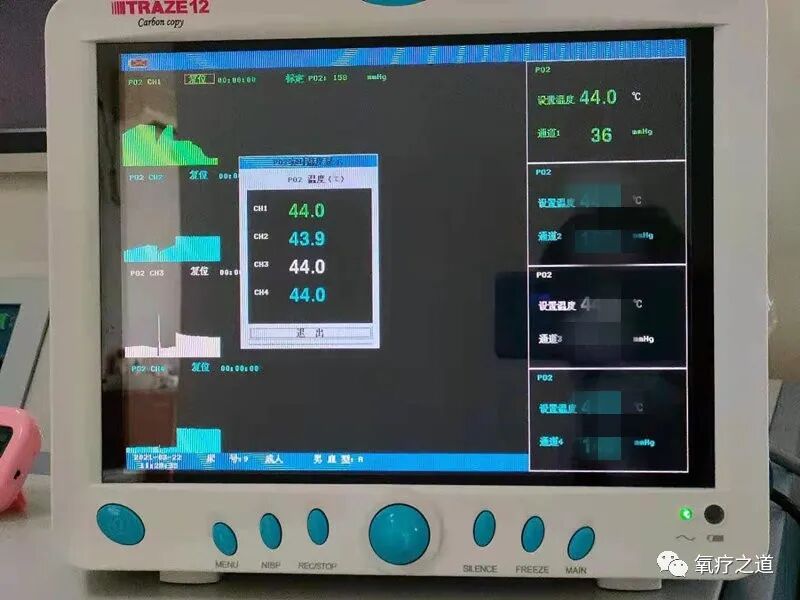 什么是经皮氧分压经皮氧分压测定在高压氧学科的应用_https://www.jmylbn.com_新闻资讯_第8张