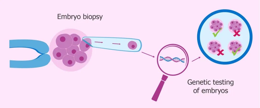 9号染色体倒位必须做试管吗_试管染色体检查结果解读_染色体试管婴儿