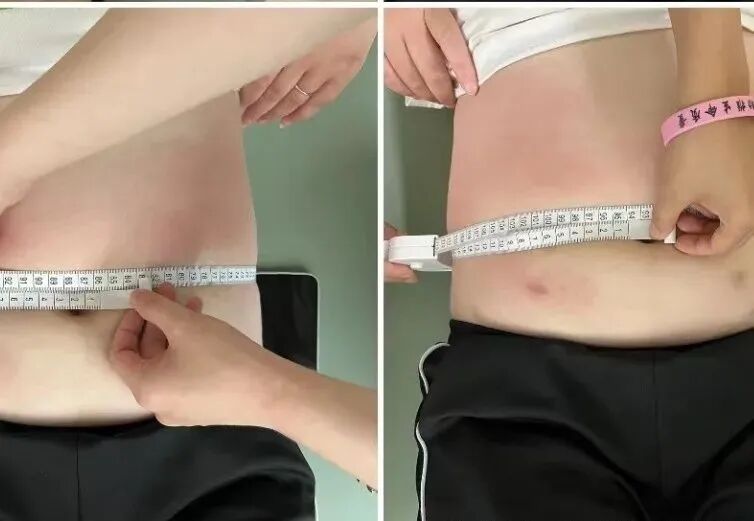 产后康复治疗是什么【孕产康复认证课程】孕产功能障碍的整体康复评估与治疗_https://www.jmylbn.com_新闻资讯_第23张