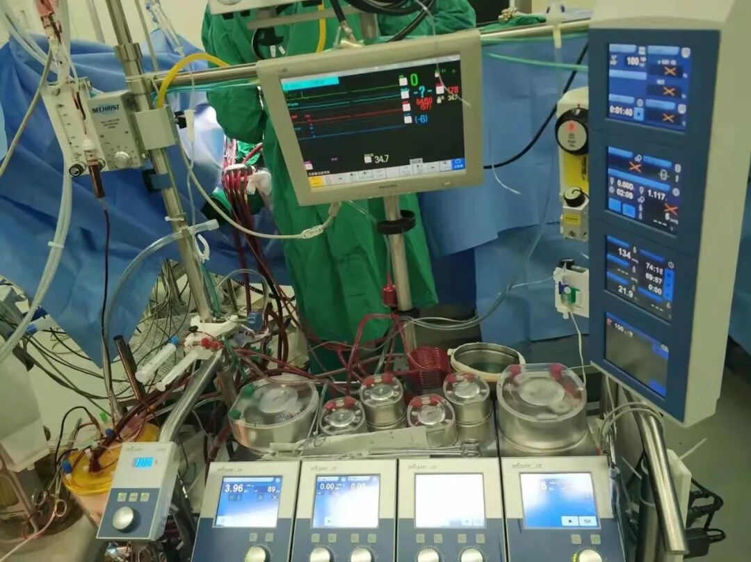 术中手术器械传递时应注意什么【新项目与新技术】手术室心脏手术配合：守护心跳的专业护航_https://www.jmylbn.com_新闻资讯_第6张