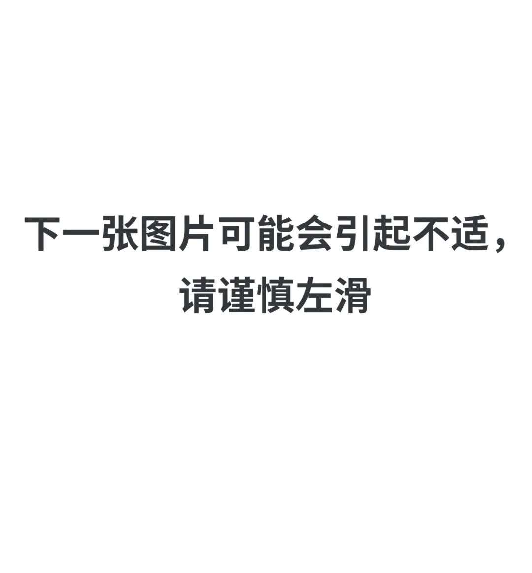防压疮垫叫什么【辅具学堂】防压疮垫妙用知多少？_https://www.jmylbn.com_新闻资讯_第4张