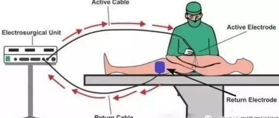 为什么手术用电刀手术室高频电刀那些事，看这篇就够了！_https://www.jmylbn.com_新闻资讯_第6张